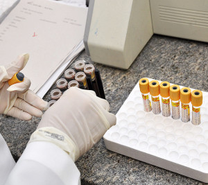 Exames laboratoriais 