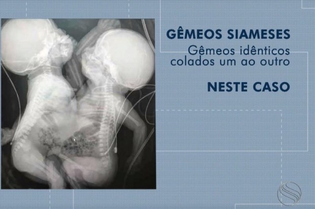 (Foto: Reprodução TV Sergipe)
